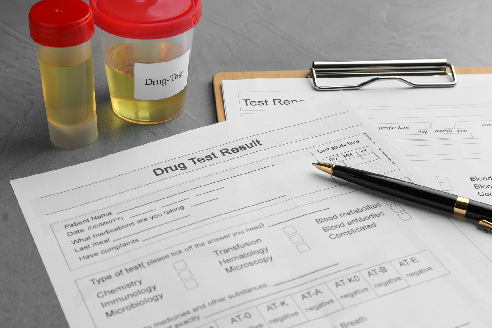 What Happens When You Miss a Drug Test While on Bond in Texas?